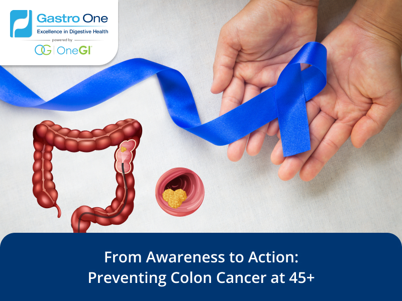 Colon cancer screening awareness for adults 45+