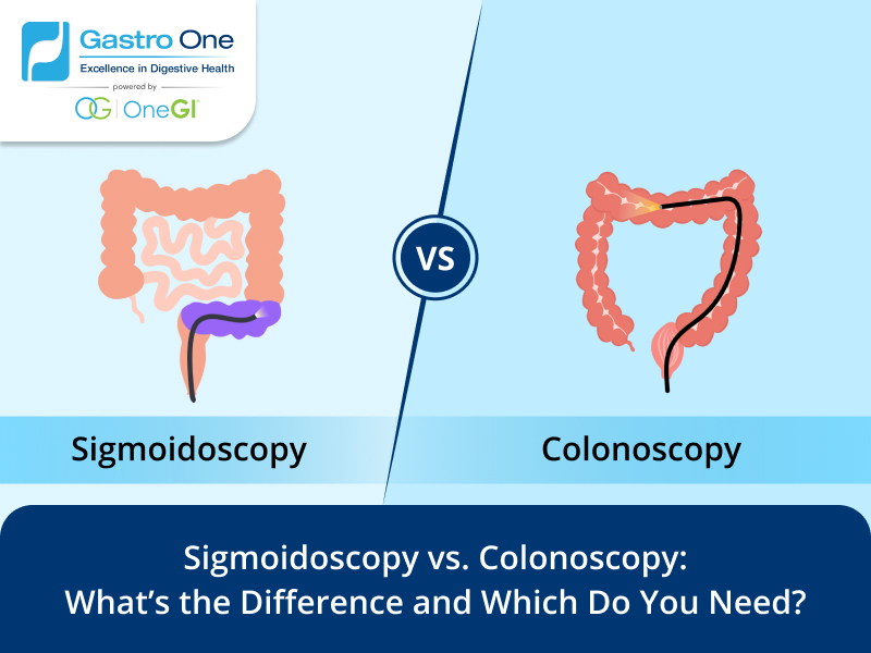 Sigmoidoscopy vs. Colonoscopy: What’s the Difference Sigmoidoscopy vs. Colonoscopy: What’s the Difference