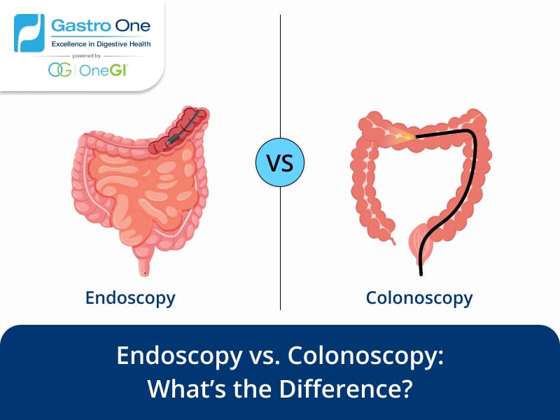 Endoscopy vs. Colonoscopy What’s the Difference and Which One Do You Need